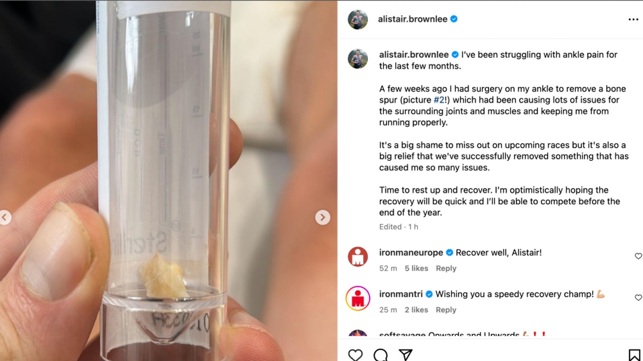 Alistair Brownlee Ankle Surgery Bone Spur